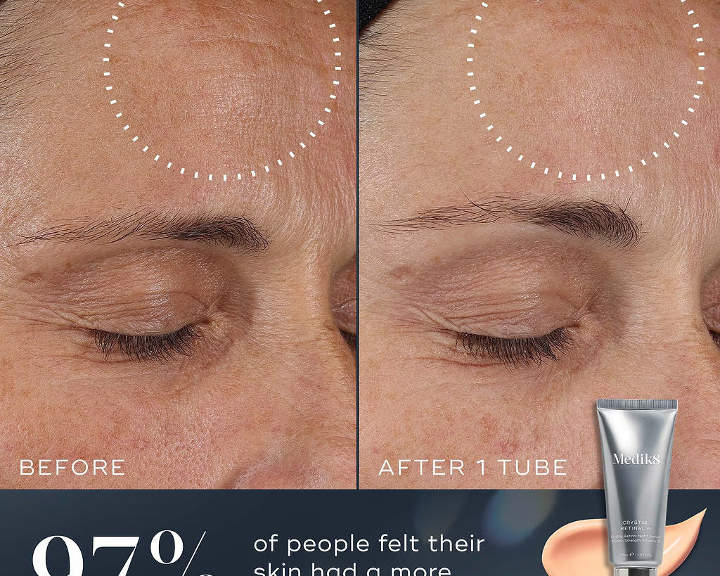 Medik8 Crystal Retinal Review: Is It Worth It?