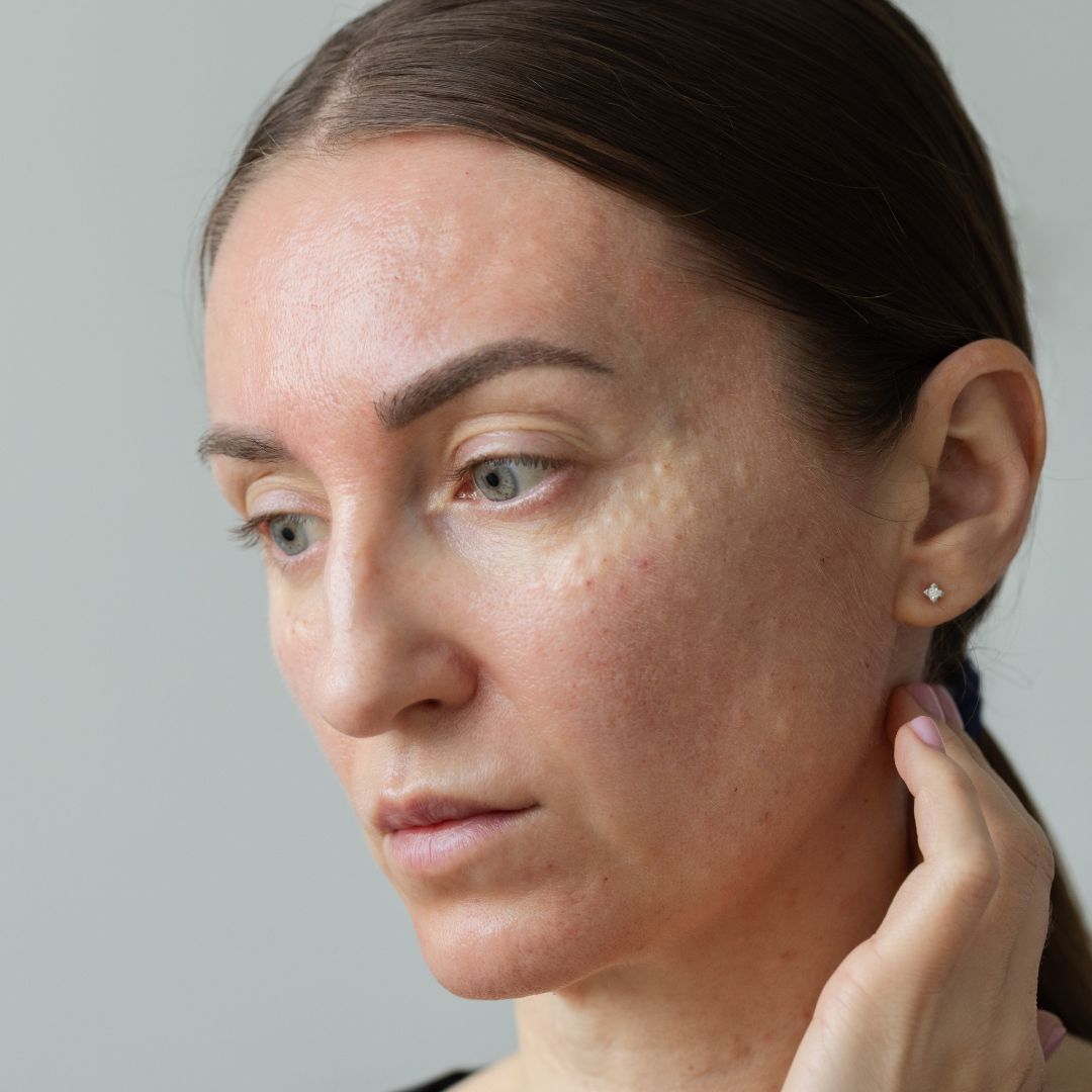 Best Cleanser for Clogged Pores: How to Choose the Right One for Clearer Skin