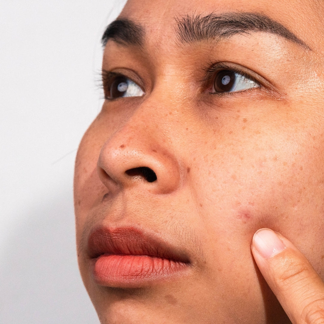 How to Brighten Dull Skin Naturally and Effectively