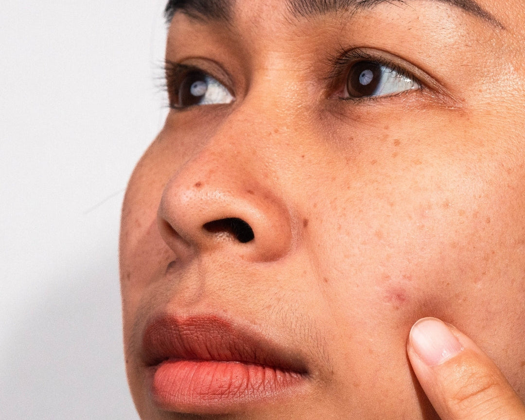 How to Brighten Dull Skin Naturally and Effectively