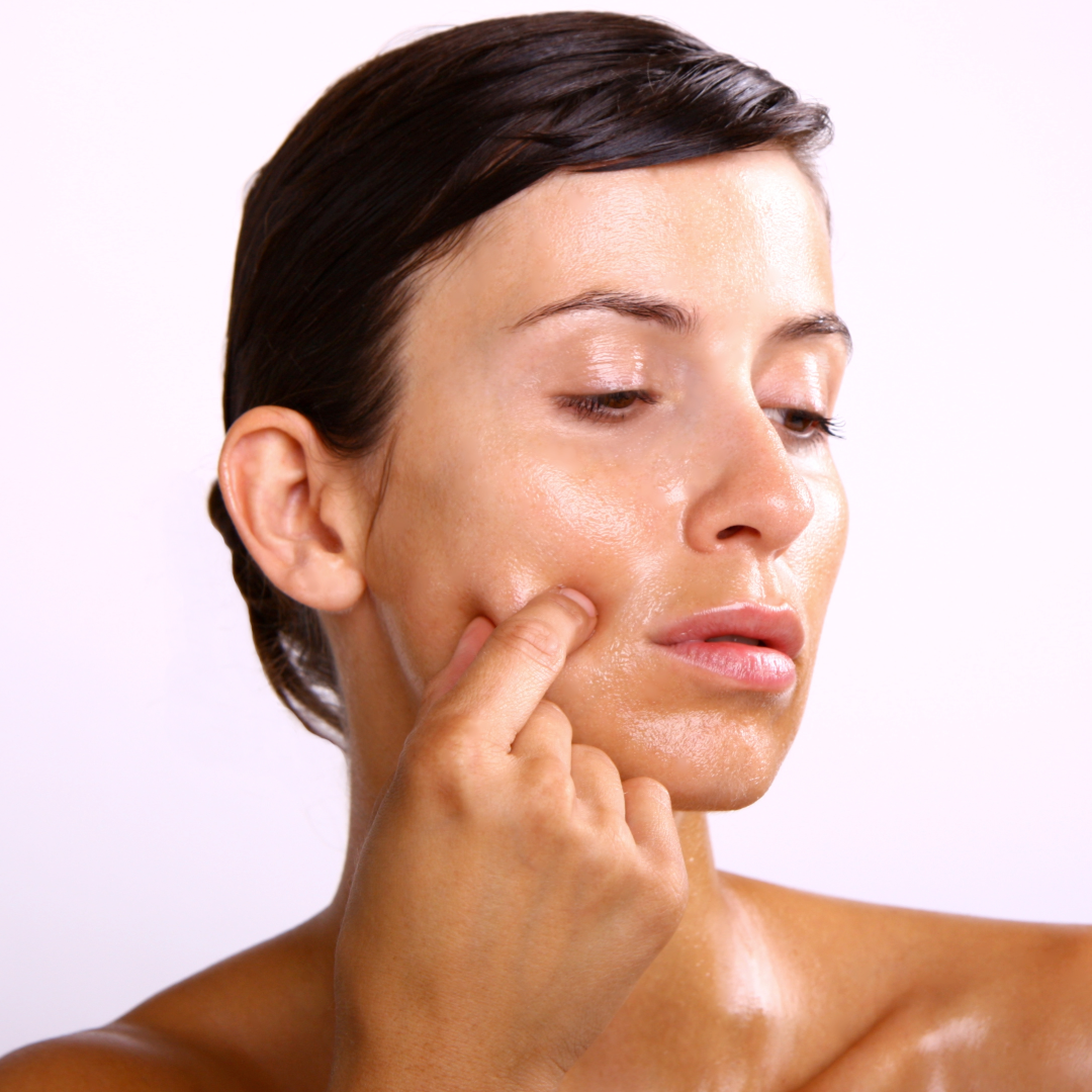 Best Moisturiser for Oily Skin: Why Oily Skin Still Needs Hydration