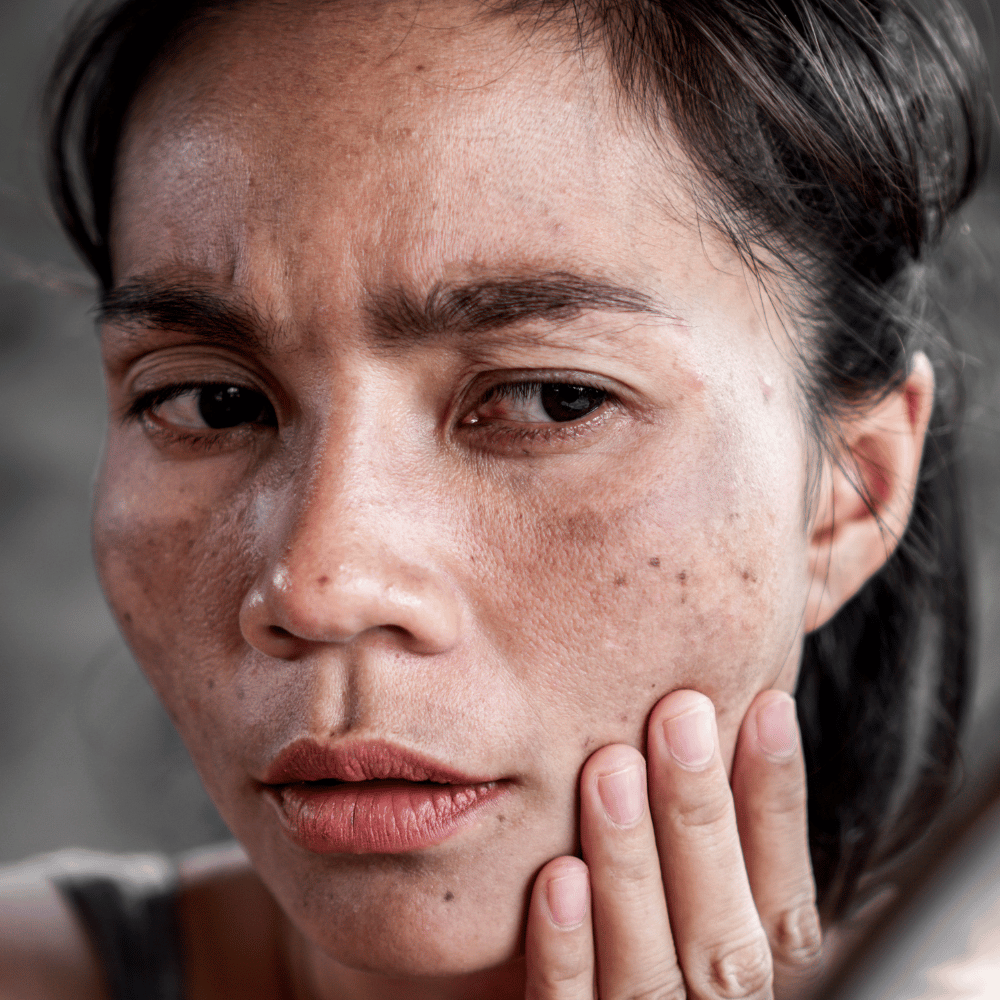 How to Reduce Sun Spots: What Actually Helps and What Is Worth Buying?