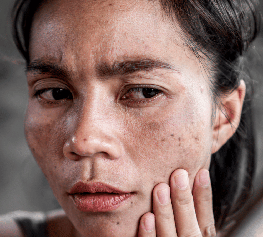 How to Reduce Sun Spots: What Actually Helps and What Is Worth Buying?