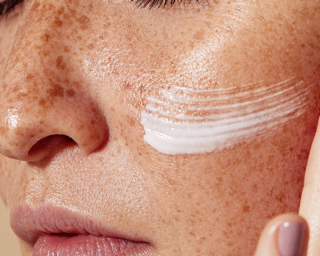 Best Vitamin C Serums in Ireland: Find the Right One for Your Skin