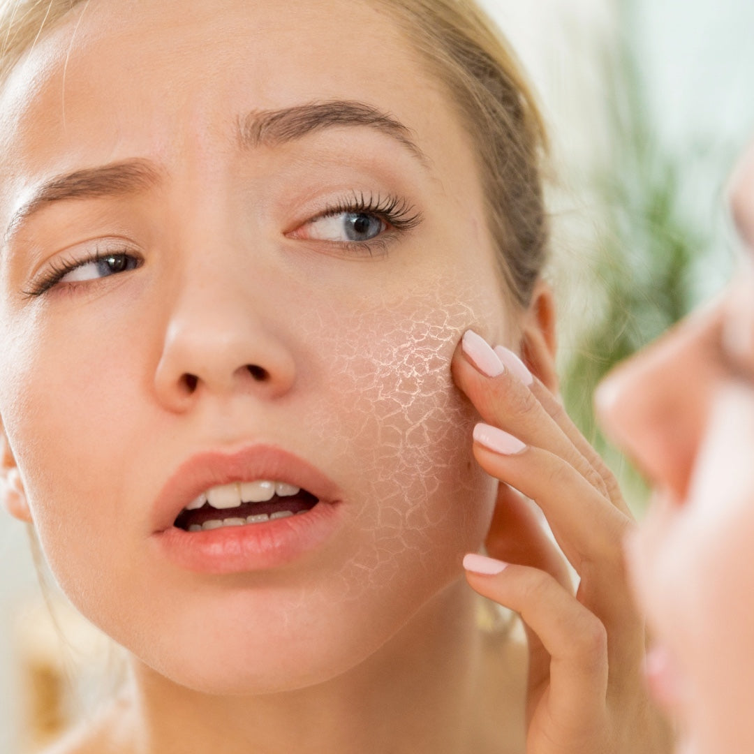 Best Moisturiser for Dry Skin: Restore Your Skin Barrier and Bring Back Lasting Hydration