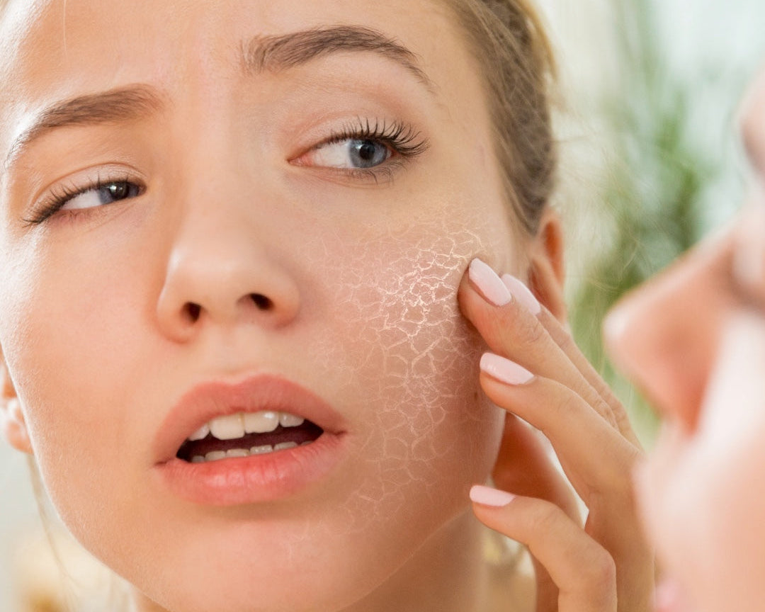 Best Moisturiser for Dry Skin: Restore Your Skin Barrier and Bring Back Lasting Hydration