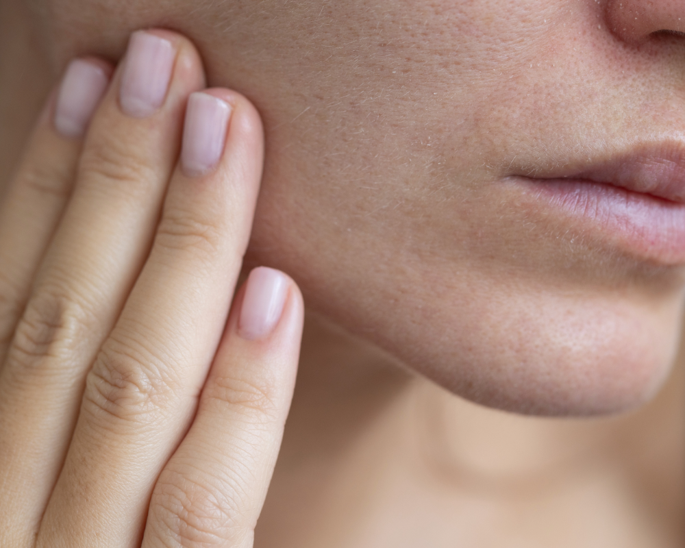Winter Acne and Dry Skin: Why Your Skin Breaks Out When It's Already Dry