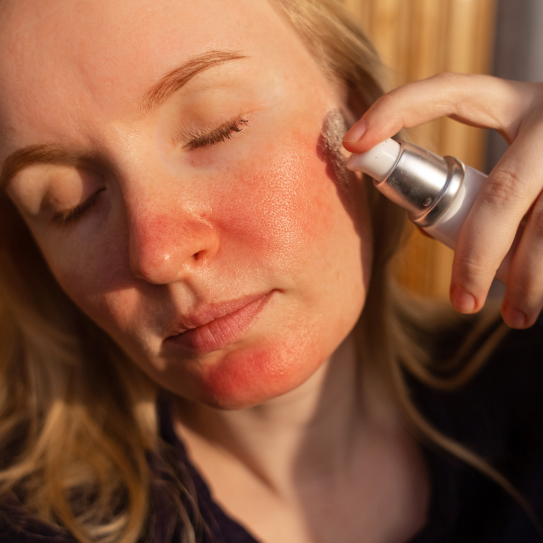 Why Does Everything Suddenly Irritate My Skin?
