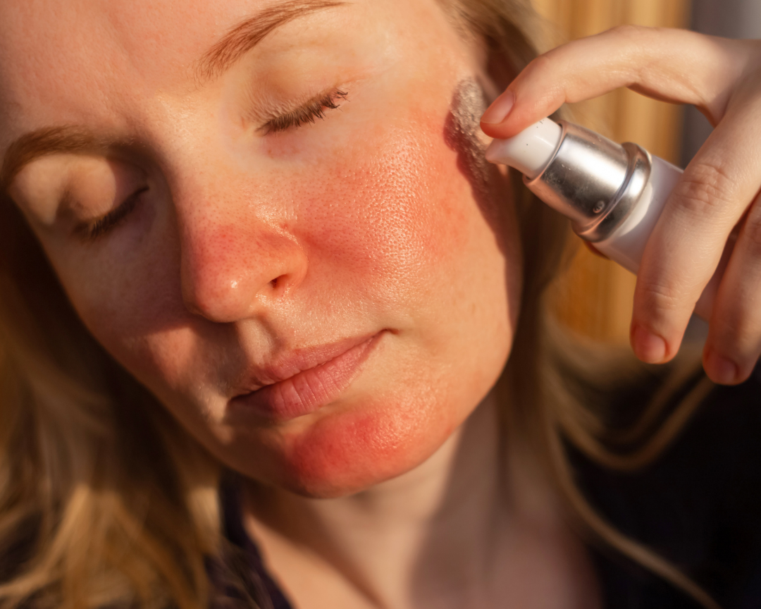 Why Does Everything Suddenly Irritate My Skin?
