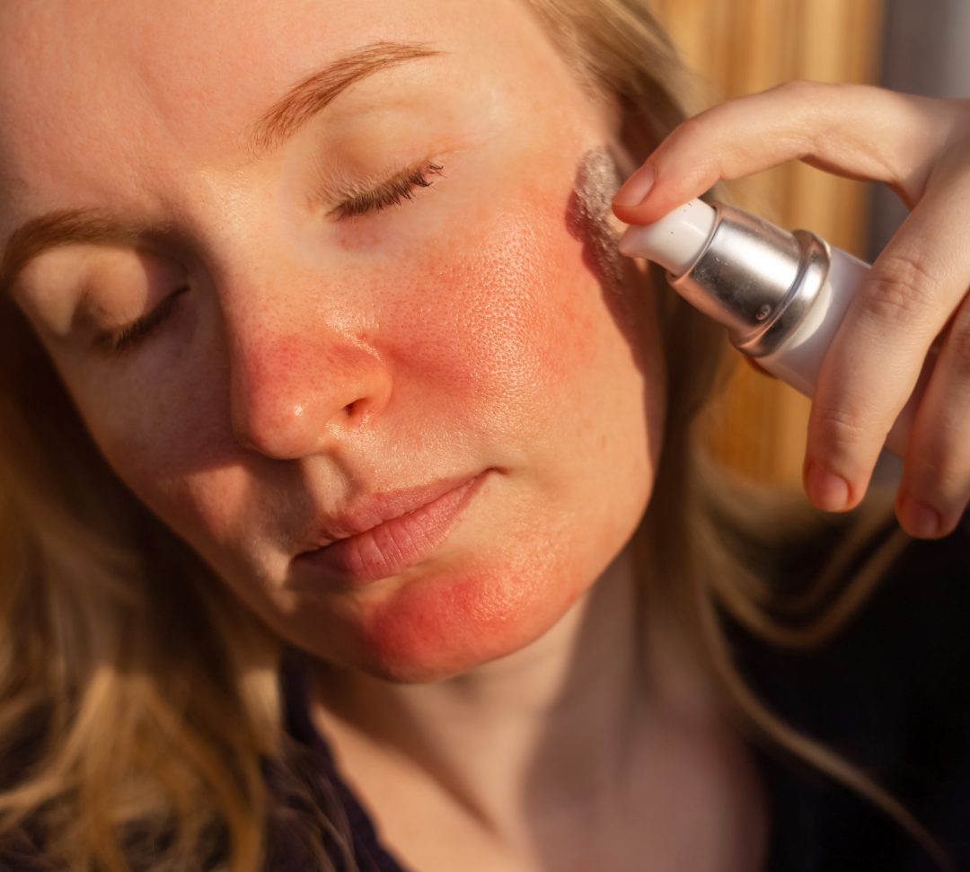 Why Does Everything Suddenly Irritate My Skin?