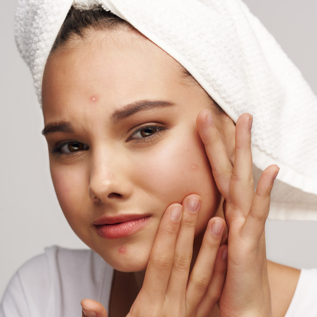 Why Does My Skin Keep Breaking Out? An Expert Guide to Building a Clearer Routine