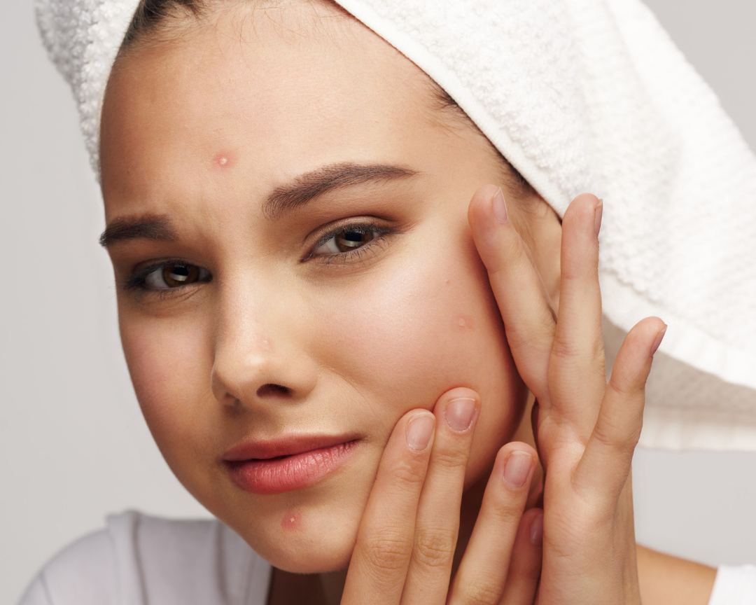 Why Does My Skin Keep Breaking Out? An Expert Guide to Building a Clearer Routine
