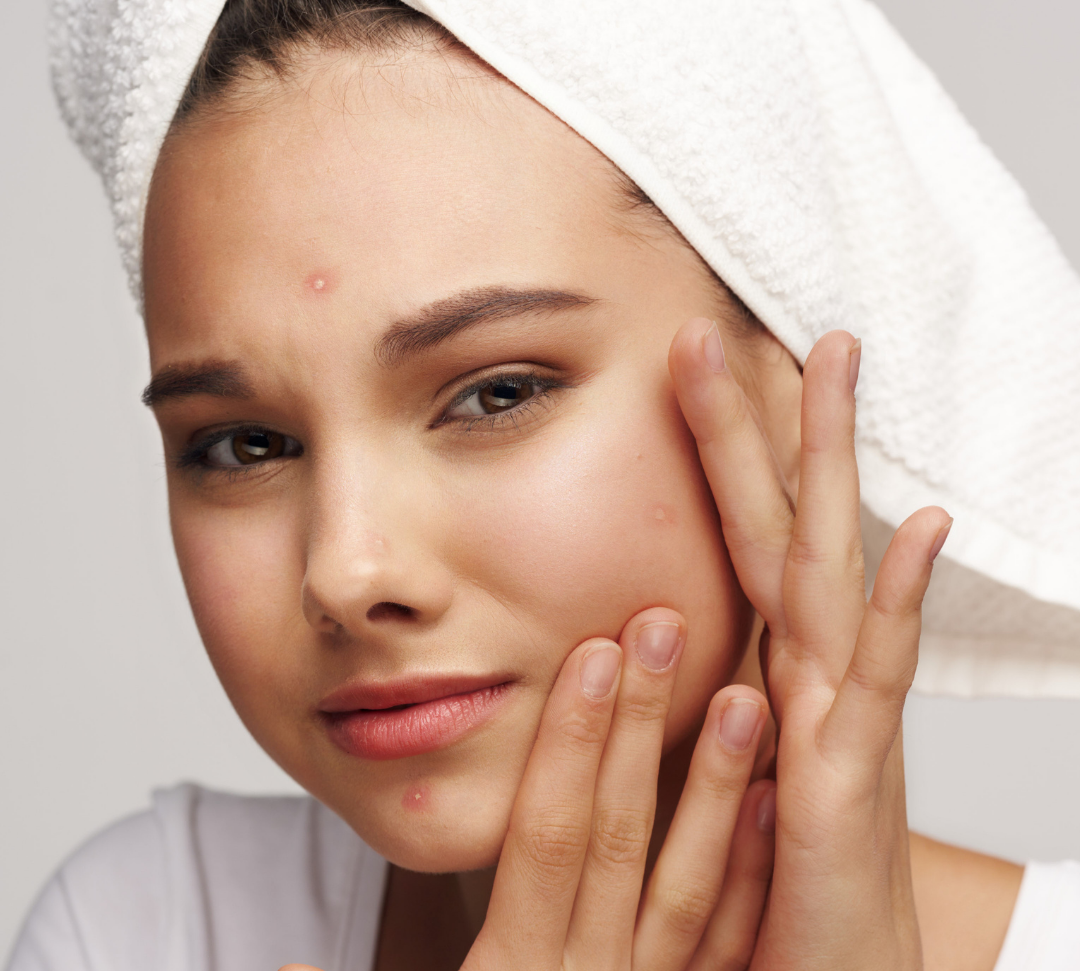 Why Does My Skin Keep Breaking Out? An Expert Guide to Building a Clearer Routine