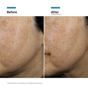 SkinCeuticals A.G.E. Defying Gift Set