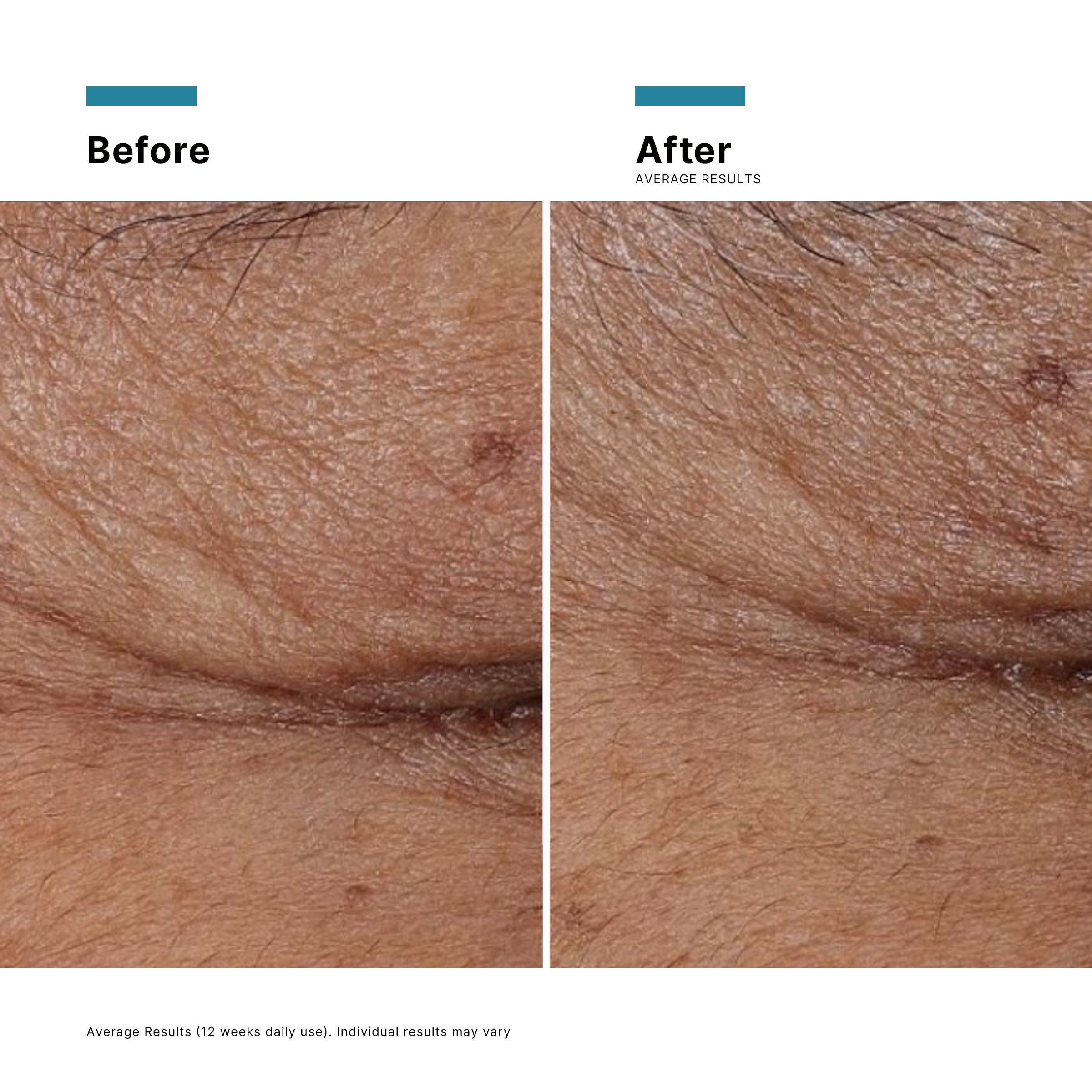SkinCeuticals Radiance Regime