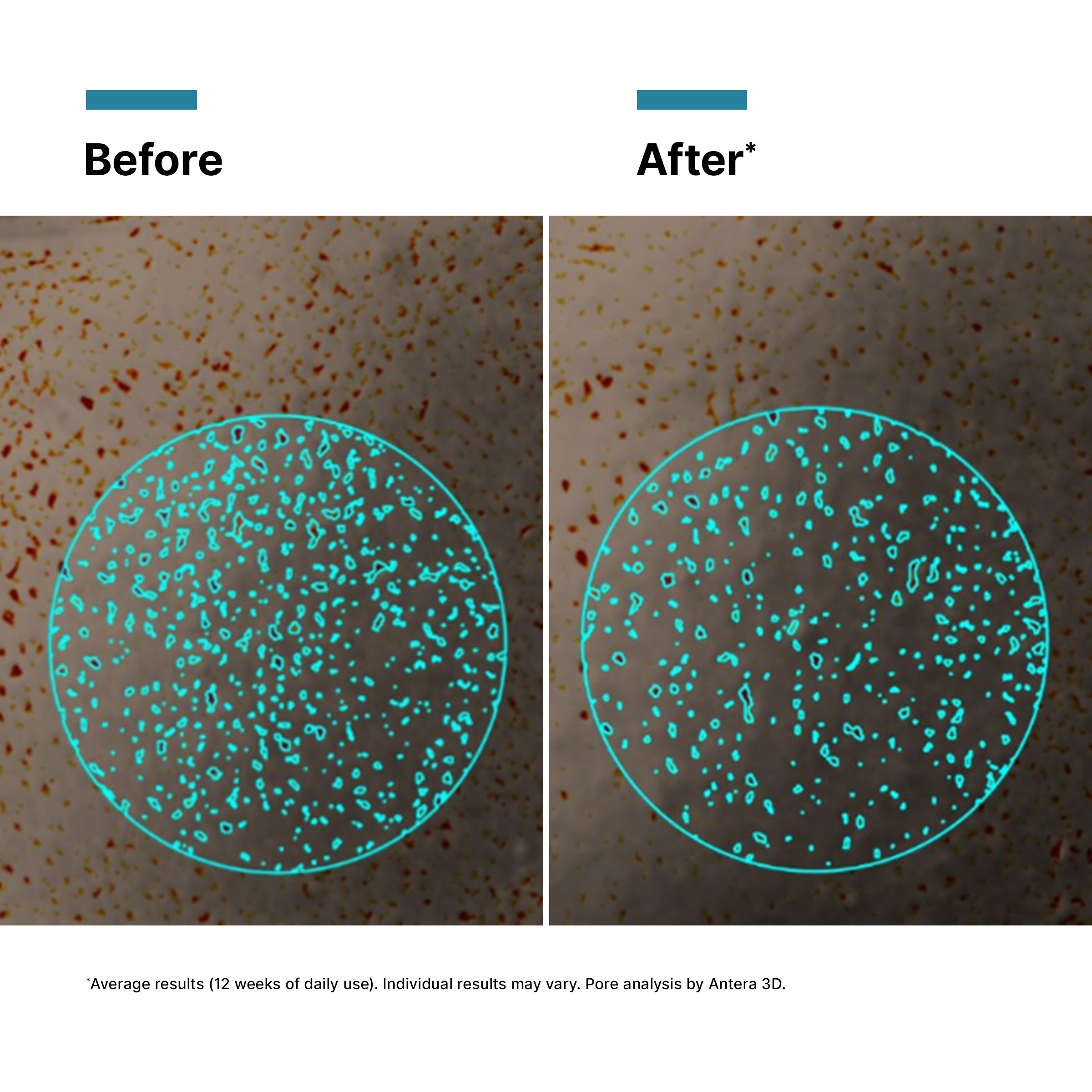 SkinCeuticals Radiance Regime