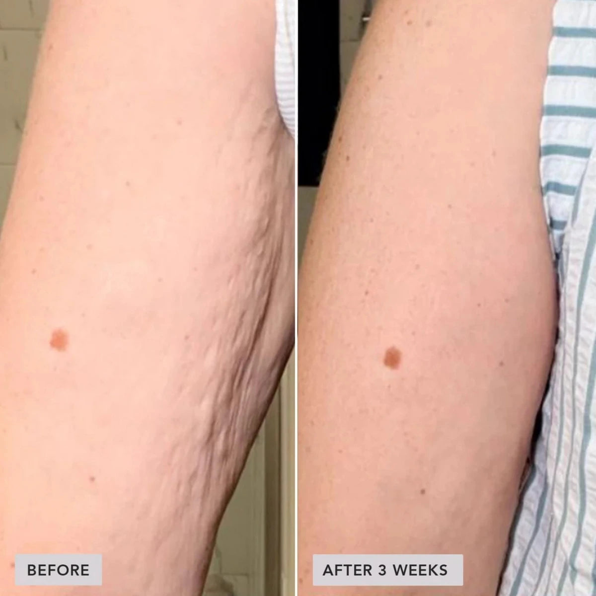 IMAGE VOL.U.LIFT BODY GLP-1/GIP Sculpt + Firm Treatment Complex