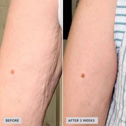 IMAGE VOL.U.LIFT BODY GLP-1/GIP Sculpt + Firm Treatment Complex
