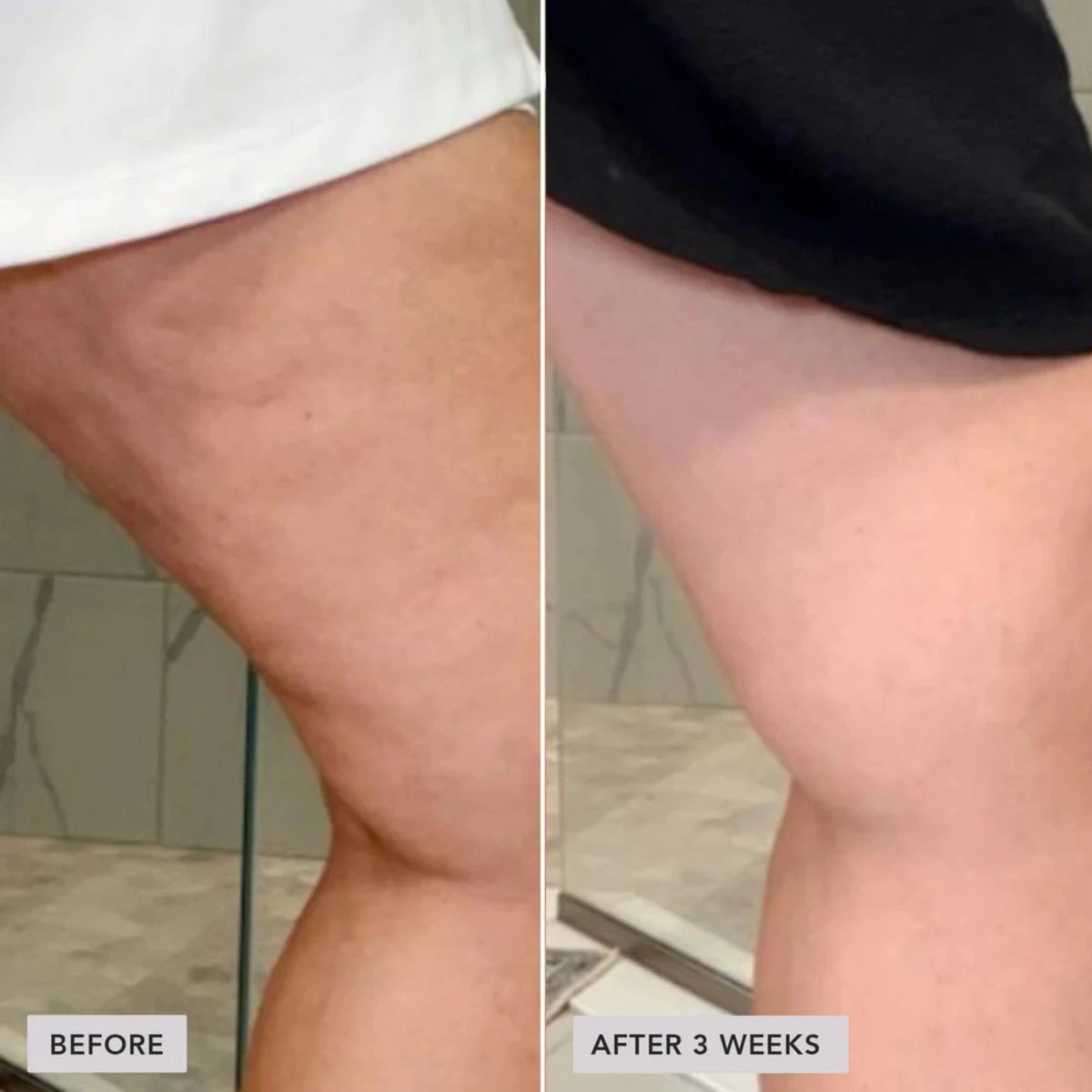 IMAGE VOL.U.LIFT BODY GLP-1/GIP Sculpt + Firm Treatment Complex