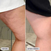 IMAGE VOL.U.LIFT BODY GLP-1/GIP Sculpt + Firm Treatment Complex