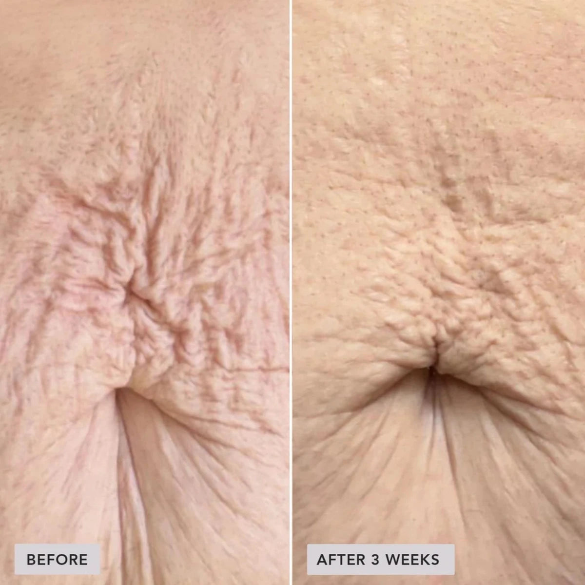 IMAGE VOL.U.LIFT BODY GLP-1/GIP Sculpt + Firm Treatment Complex