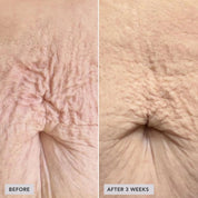 IMAGE VOL.U.LIFT BODY GLP-1/GIP Sculpt + Firm Treatment Complex