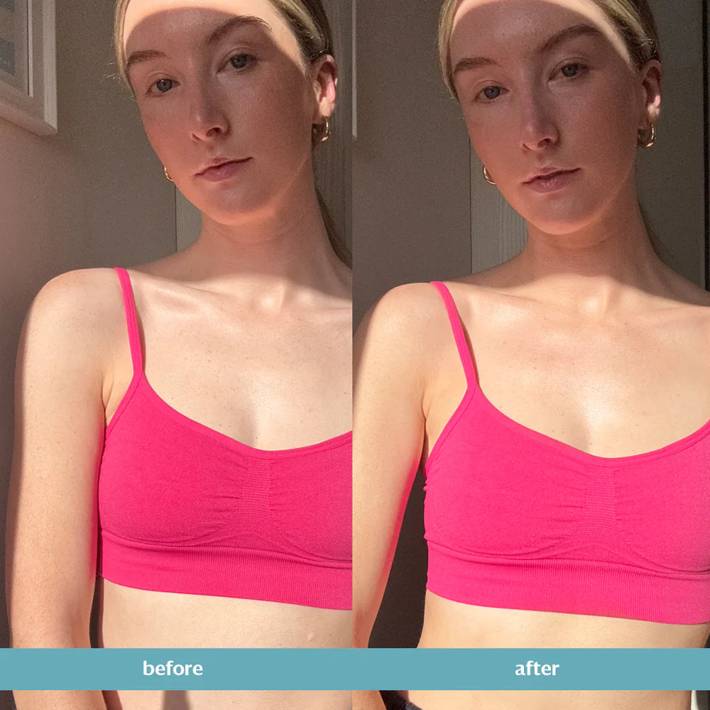 BEFORE_AFTERMEDIUM.webp