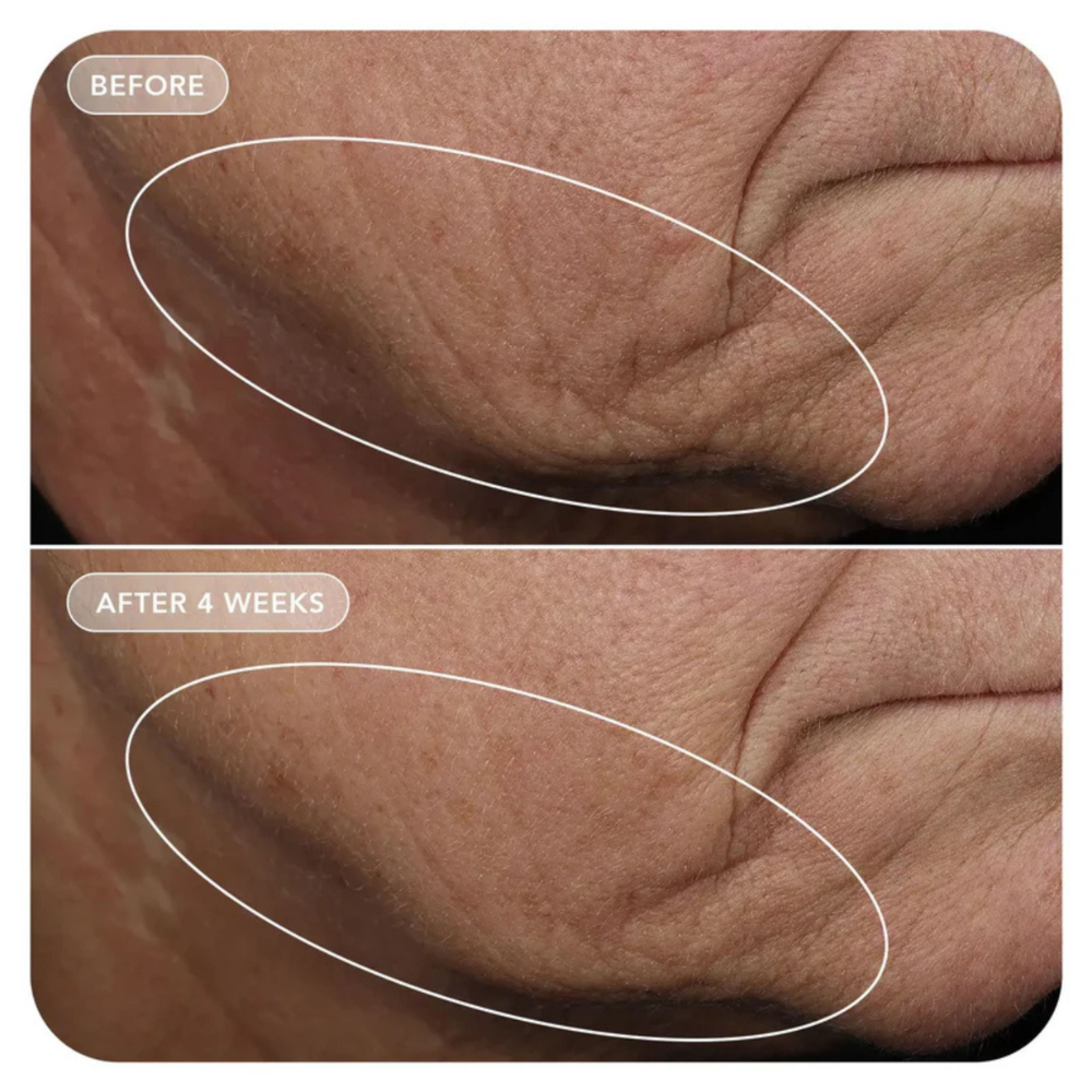 IMAGE Skincare VOL.U.LIFT™ GLP-1 4D Skin Rebound Complex