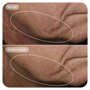 IMAGE Skincare VOL.U.LIFT™ GLP-1 4D Skin Rebound Complex