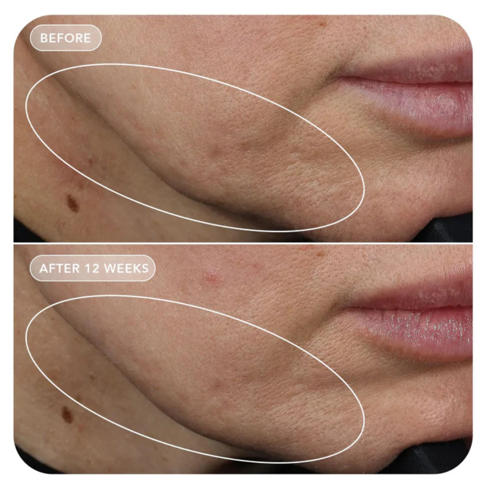 IMAGE Skincare VOL.U.LIFT™ GLP-1 4D Skin Rebound Complex (57ml)