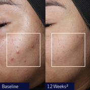 Obagi NU-GEN™ Cellular Renewal Serum