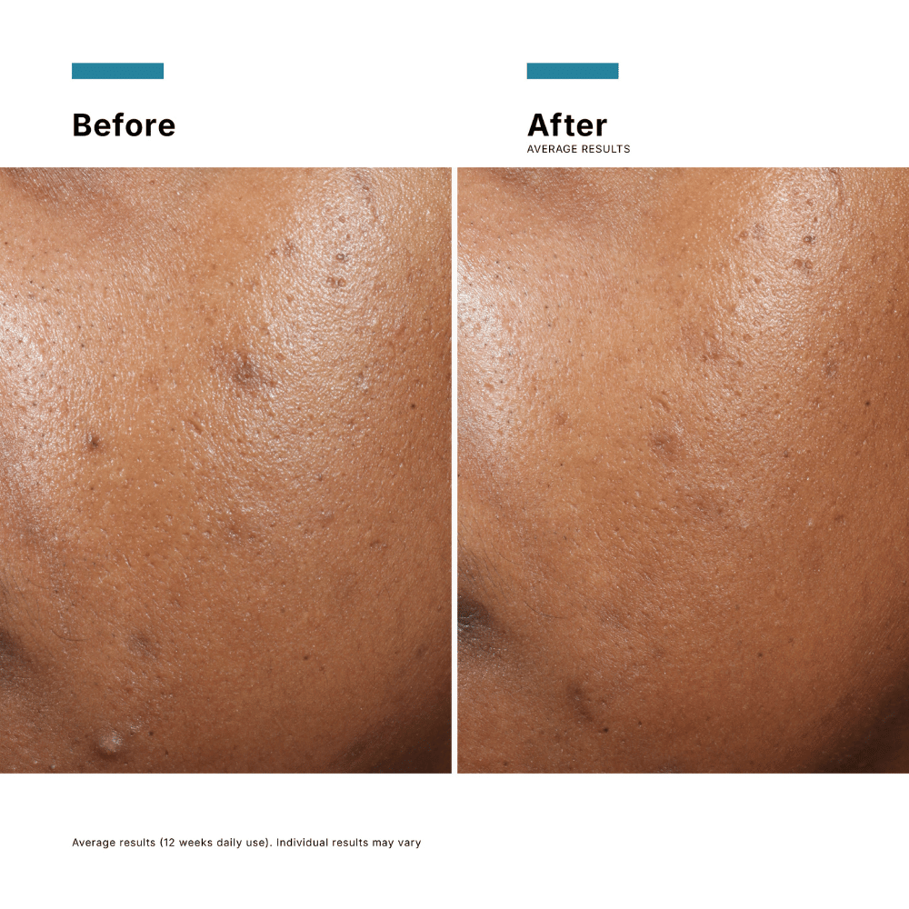 SkinCeuticals Phyto A+ Brightening Treatment