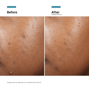SkinCeuticals Phyto A+ Brightening Treatment
